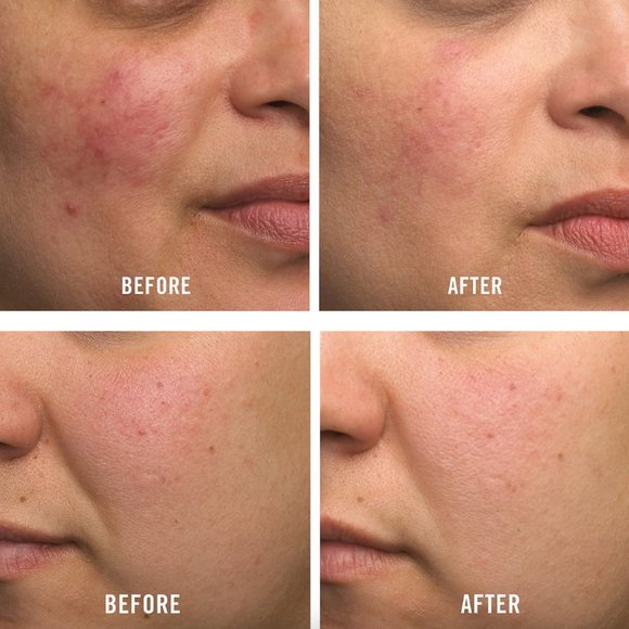 🌶4/$12 NEW First Aid Beauty Ultra Repair Cream Intense Hydration for Dry Skin - Picture 4 of 5